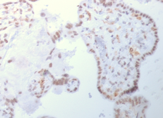 Anti-DNMT3A antibody [PCRP-DNMT3A-1E2] used in IHC (Paraffin sections) (IHC-P). GTX18052