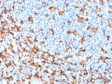Anti-Iba1 antibody [rAIF1/1909] used in IHC (Paraffin sections) (IHC-P). GTX18053