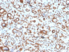 Anti-Emerin antibody [EMD/2167] used in IHC (Paraffin sections) (IHC-P). GTX18054
