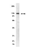 Anti-alpha Actinin 1 antibody [0.T.02] used in Western Blot (WB). GTX18061