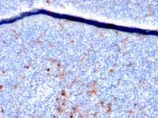Anti-IL2 Receptor alpha antibody [IL2RA/2395] used in IHC (Paraffin sections) (IHC-P). GTX18115