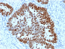 Anti-p53 antibody [PCRP-TP53-2A10] used in IHC (Paraffin sections) (IHC-P). GTX18125