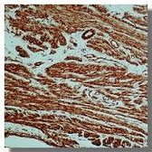 Anti-alpha Smooth Muscle Actin antibody [0.N.5] used in IHC (Paraffin sections) (IHC-P). GTX18147