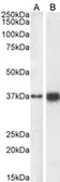 Anti-SOX2 antibody used in Western Blot (WB). GTX18149