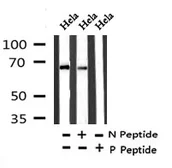 Anti-PLK1 (phospho Tyr217) antibody used in Western Blot (WB). GTX18156