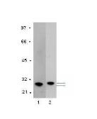 Anti-GST tag antibody [GST.B6] used in Western Blot (WB). GTX18183