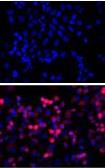 Anti-6X His tag antibody [HIS.H8] used in Immunocytochemistry/ Immunofluorescence (ICC/IF). GTX18184