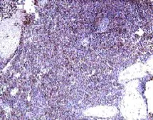 Anti-IL22 Receptor alpha 2 antibody used in IHC (Paraffin sections) (IHC-P). GTX18566