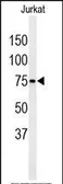 Anti-PAN3 antibody used in Western Blot (WB). GTX18622