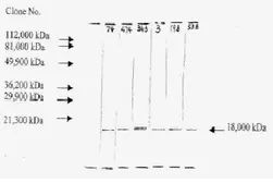 Anti-FGF2 antibody [F-474] used in Western Blot (WB). GTX18634