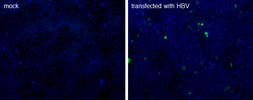 Anti-Hepatitis B virus Core Antigen antibody [10E11] used in Immunocytochemistry/ Immunofluorescence (ICC/IF). GTX18686