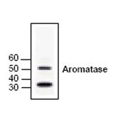 Anti-Aromatase antibody used in Western Blot (WB). GTX18995