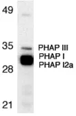 Anti-PHAP antibody used in Western Blot (WB). GTX19281