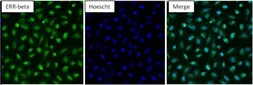 Anti-ERR beta antibody used in Immunocytochemistry/ Immunofluorescence (ICC/IF). GTX19331