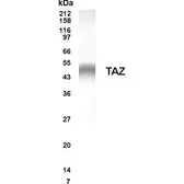 Anti-GCSF Receptor antibody [S1390] used in Western Blot (WB). GTX19479