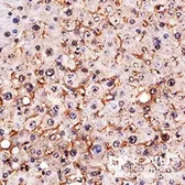 Anti-SR-BI antibody used in IHC (Paraffin sections) (IHC-P). GTX20003