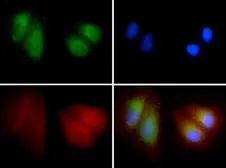 Anti-LIMP II antibody used in Immunocytochemistry/ Immunofluorescence (ICC/IF). GTX20114