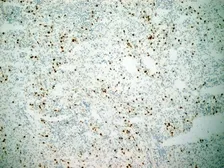Anti-CD11b antibody [ICRF44] used in IHC (Frozen sections) (IHC-Fr). GTX20183