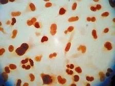 Anti-APE1 antibody [13B8E5C2] used in Immunocytochemistry/ Immunofluorescence (ICC/IF). GTX20194