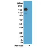 Rabbit Anti-Mouse IgA antibody [RM220]. GTX20289