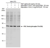 Anti-PKC theta (phospho Thr538) antibody used in Western Blot (WB). GTX20304