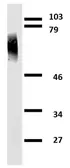 Anti-Clusterin antibody [Hs-3] used in Western Blot (WB). GTX20349