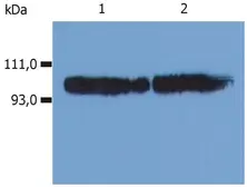 Anti-CD18 antibody [MEM-48] used in Western Blot (WB). GTX20657