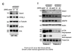 Anti-Serum Amyloid A antibody [115] used in Western Blot (WB). GTX20687