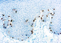 Anti-Tyrosinase antibody [T311] used in IHC (Paraffin sections) (IHC-P). GTX20738