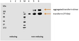 Anti-Transferrin antibody [HTF-14] used in Western Blot (WB). GTX20769
