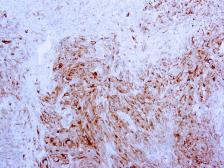 Anti-Melan A antibody [A103] used in IHC (Paraffin sections) (IHC-P). GTX20785