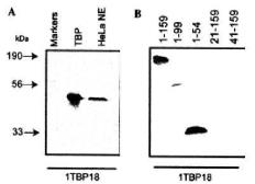 Anti-TBP antibody [1TBP18] used in Western Blot (WB). GTX20818