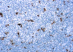 Anti-CD68 antibody [PG-M1] (ready-to-use) used in IHC (Paraffin sections) (IHC-P). GTX20844