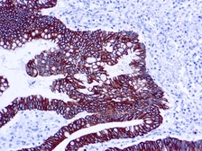 Anti-Cytokeratin 8 + 18 antibody [5D3] (ready-to-use) used in IHC (Paraffin sections) (IHC-P). GTX20847