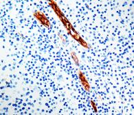 Anti-VWF antibody [F8/86] (ready-to-use) used in IHC (Paraffin sections) (IHC-P). GTX20855