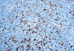 Anti-CD30 antibody [Ber-H2] (ready-to-use) used in IHC (Paraffin sections) (IHC-P). GTX20871