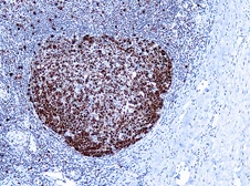 Anti-PCNA antibody [PC10] (ready-to-use) used in IHC (Paraffin sections) (IHC-P). GTX20912