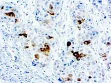 Anti-Alpha fetoprotein / AFP antibody (ready-to-use) used in IHC (Paraffin sections) (IHC-P). GTX20920