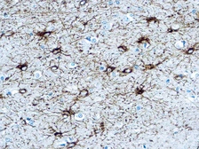 Anti-GFAP antibody (ready-to-use) used in IHC (Paraffin sections) (IHC-P). GTX20929