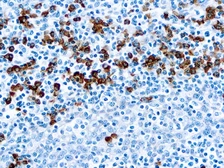 Rabbit Anti-Human IgG antibody (ready-to-use). GTX20938