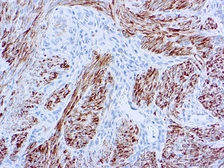 Anti-Desmin antibody [D33] (ready-to-use) used in IHC (Paraffin sections) (IHC-P). GTX20959