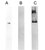 Anti-HMW Kininogen antibody [C11C1] used in Western Blot (WB). GTX21004