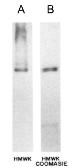 Anti-HMW Kininogen antibody [2B5] used in Western Blot (WB). GTX21005