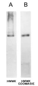 Anti-HMW Kininogen antibody [2B5] used in Western Blot (WB). GTX21005