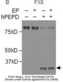 Anti-Factor XII Light chain antibody [C6B7] used in Western Blot (WB). GTX21008