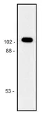 Anti-beta Galactosidase antibody [BG-02] used in Western Blot (WB). GTX21047