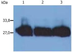 Mouse Anti-Human kappa light chain antibody [MEM-09]. GTX21050