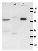 Anti-CD4 antibody [MEM-241] used in Western Blot (WB). GTX21089
