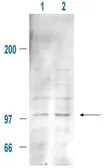 Anti-MDM2 (phospho Ser185) antibody used in Western Blot (WB). GTX21094