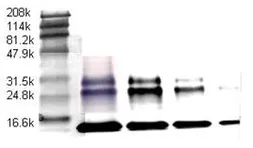 Anti-TGF beta antibody [TB21] used in Western Blot (WB). GTX21279